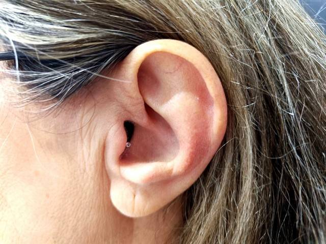 Φωτογραφία: Αόρατα ακουστικά βαρηκοΐας IIC Ελβετικής τεχνολογίας