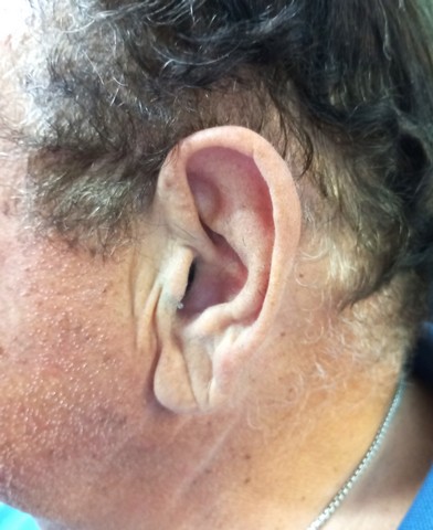 iic hearing aid left